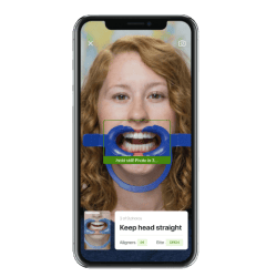 Invisalign virtual care